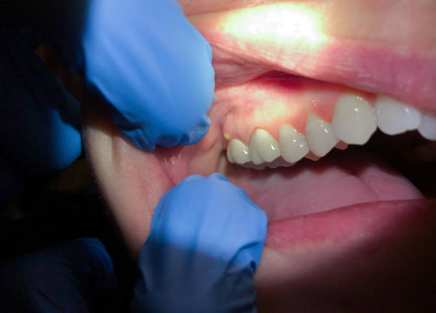 Best Emergency Root Canal Treatment in Greenland, AR