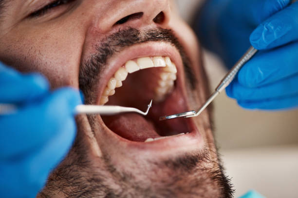 Best Emergency Dental Care for Broken or Chipped Teeth in Greenland, AR